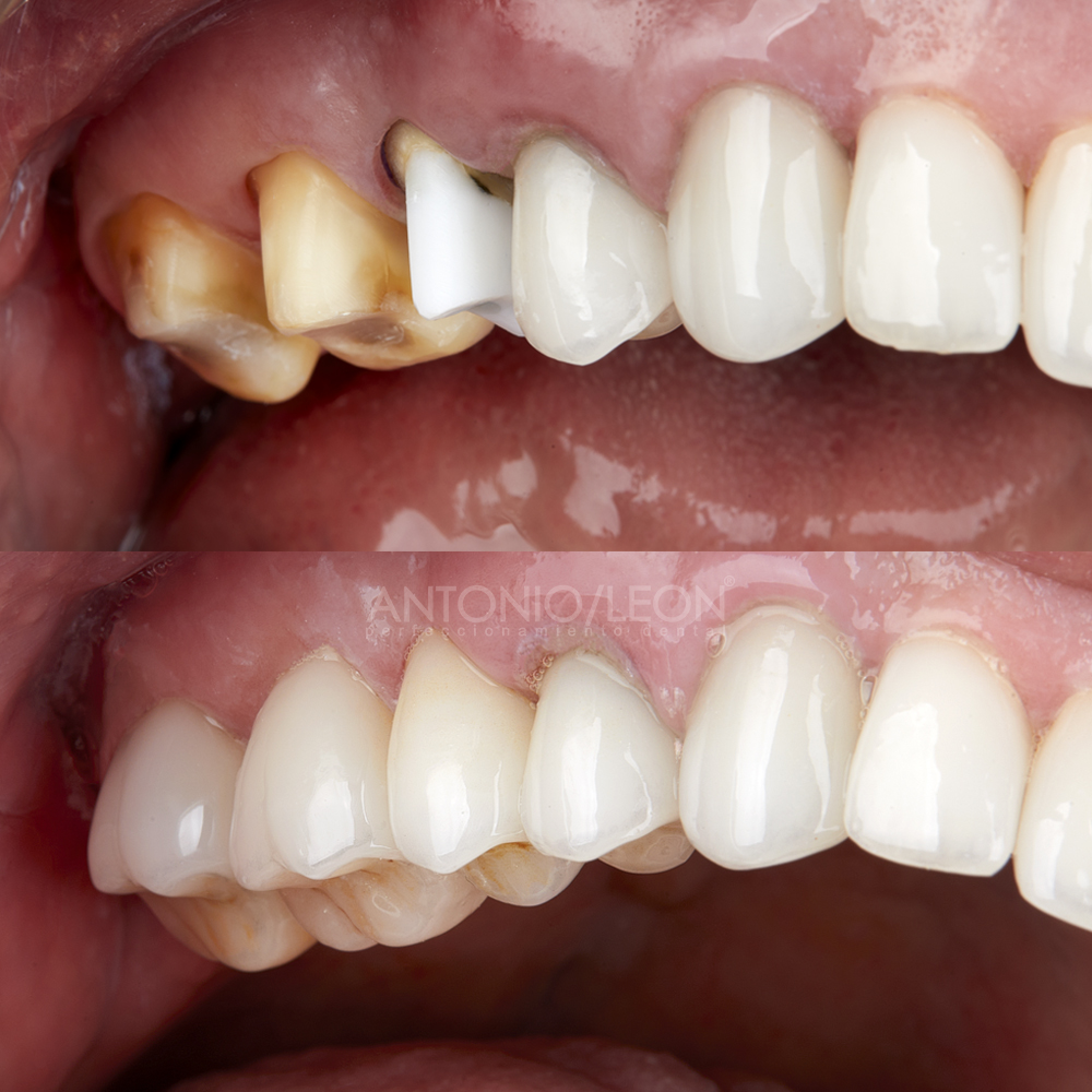 Jose Orlando buritica2